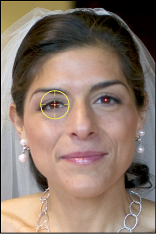 Figure. Image showing a Red Eye target overlay placed over a subject's red eye.