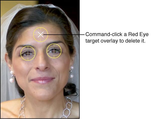 Figure. Image showing a white X appearing over a Red Eye target overlay, indicating that you can delete it.