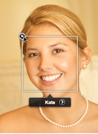 Figure. Remove button for a positioning box and face label.