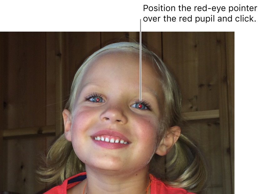 A photo of a child showing a red pupil.