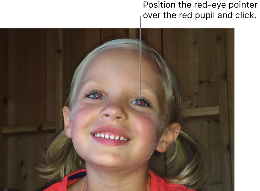 A photo of a child showing a red pupil.