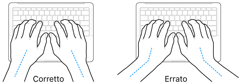 Mani posizionate su una tastiera che illustrano l'allineamento corretto ed errato di polso e mano.