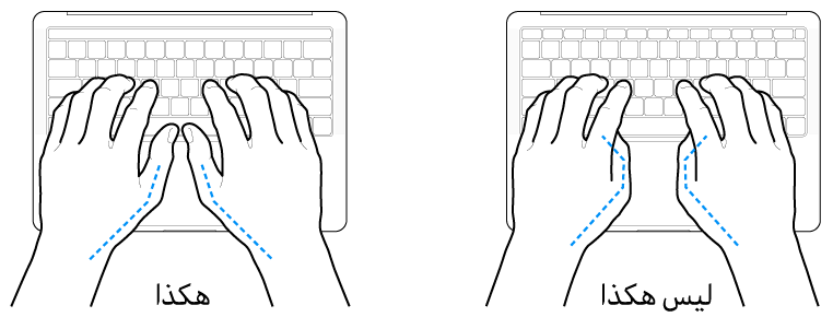 يدان موضوعتان على لوحة مفاتيح، ويظهر الوضع الصحيح وغير الصحيح للإبهامين.