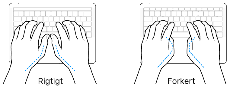 Hænder anbragt over et tastatur med rigtig og forkert position af tommelfingre.