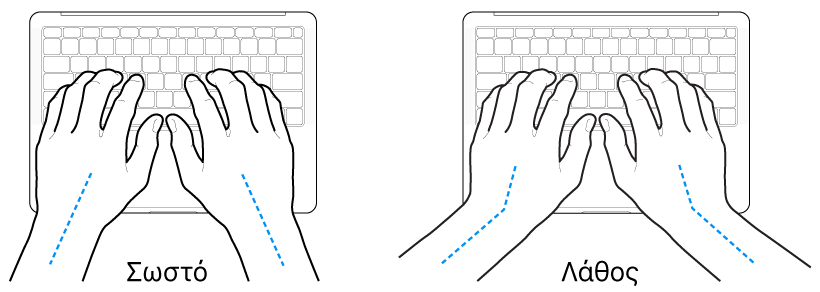 Χέρια τοποθετημένα επάνω σε ένα πληκτρολόγιο, που δείχνουν τη σωστή και τη λανθασμένη θέση των καρπών σε σχέση με τα χέρια.