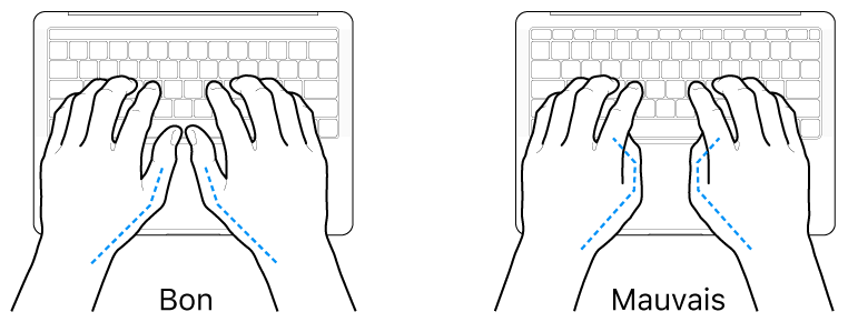 Mains placées sur un clavier, montrant la bonne et la mauvaise position des pouces.