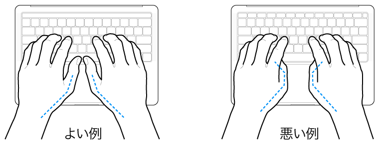 キーボードに置かれた手。親指の適切な位置と不適切な位置を示しています。