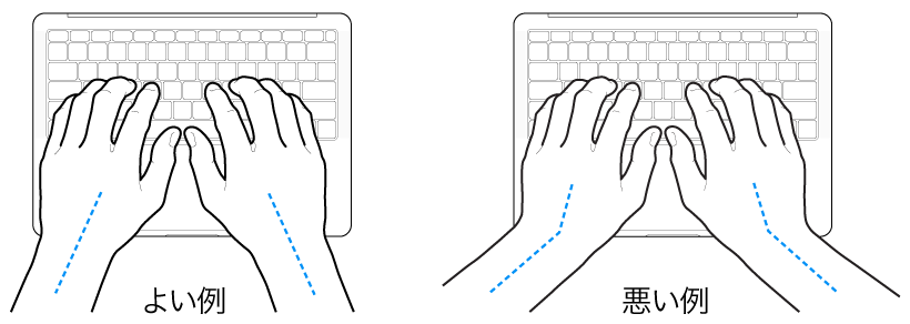 キーボードに置かれた手。手首と手の適切な位置関係と不適切な位置関係を示しています。
