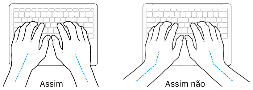 As mãos posicionadas sobre um teclado a mostrar alinhamentos corretos e incorretos das mãos e dos pulsos.