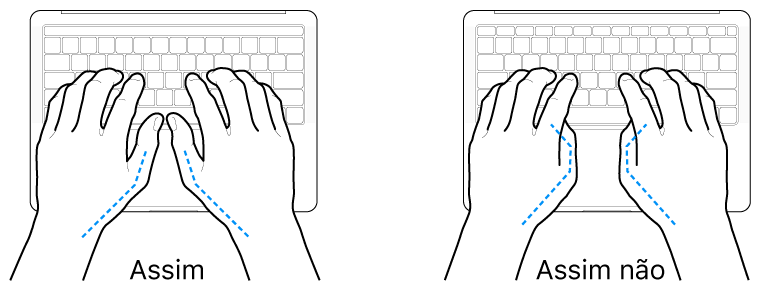 As mãos posicionadas sobre um teclado a mostrar a colocação correta e incorreta dos polegares.