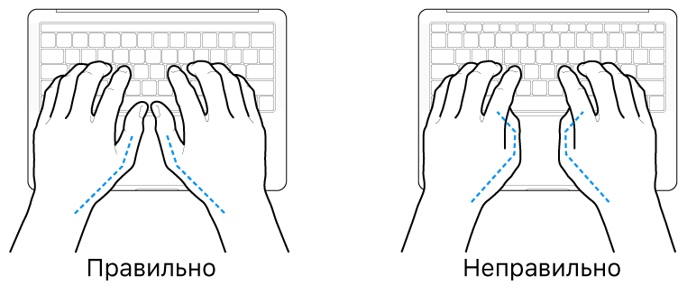 Руки розташовано над клавіатурою й показано правильне та неправильне положення великих пальців.