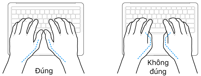 Các bàn tay đặt phía trên bàn phím, minh họa cách đặt ngón cái đúng và sai.