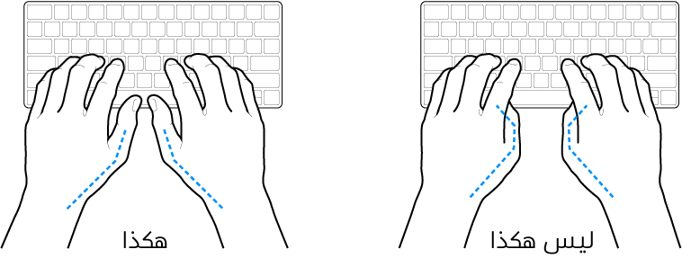 يدان موضوعتان على لوحة مفاتيح، ويظهر الوضع الصحيح وغير الصحيح للإبهامين.