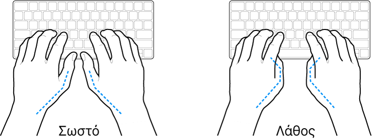 Χέρια τοποθετημένα επάνω σε ένα πληκτρολόγιο, που δείχνουν τη σωστή και τη λανθασμένη θέση των αντίχειρων.