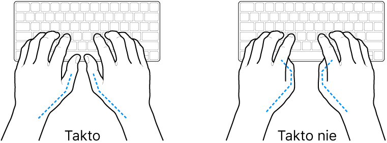 Ruky položené na klávesnici znázorňujúce správnu a nesprávnu polohu palcov.