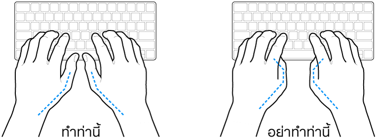 มือวางอยู่เหรือแป้นพิมพ์ แสดงตำแหน่งการวางนิ้วหัวแม่มือที่ถูกต้องและไม่ถูกต้อง