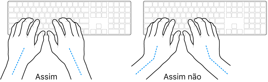 As mãos posicionadas sobre um teclado a mostrar alinhamentos corretos e incorretos das mãos e dos pulsos.