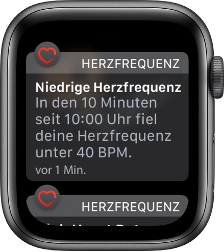 Ein Warnbildschirm mit dem Hinweist, dass eine zu niedrige Herzfrequenz festgestellt wurde.