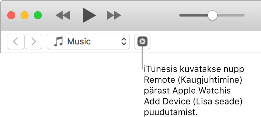 iTunesi nupp Remote kuvatakse, kui üritate lisada kogu Apple Watchi.