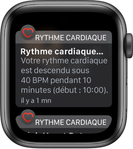 Un écran d’alerte de rythme cardiaque indiquant qu’un rythme cardiaque faible a été détecté.