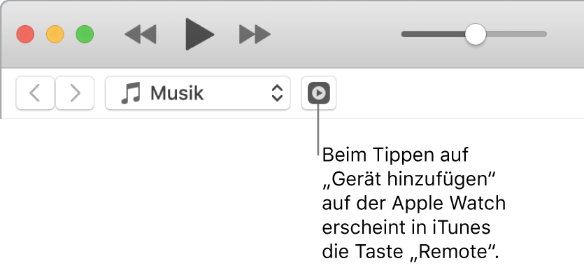 Die Taste „Remote“ wird in iTunes angezeigt, während du versuchst, die Mediathek zur Apple Watch hinzuzufügen.