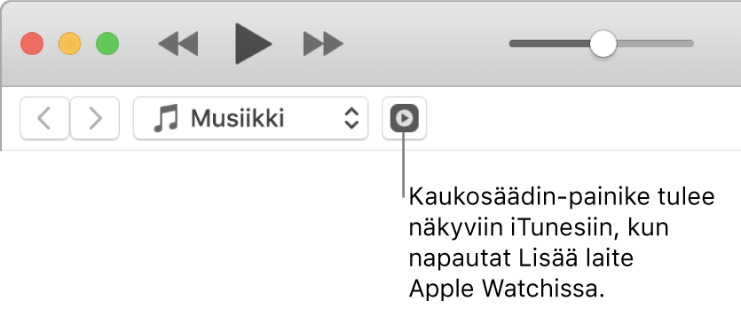 Kaukosäädin-painike tulee näkyviin iTunesissa, kun yrität lisätä kirjastoa Apple Watchiin.