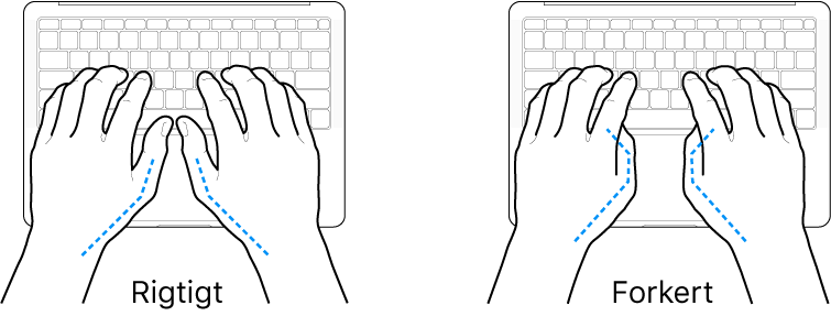 Hænder anbragt over et tastatur med rigtig og forkert position af tommelfingre.