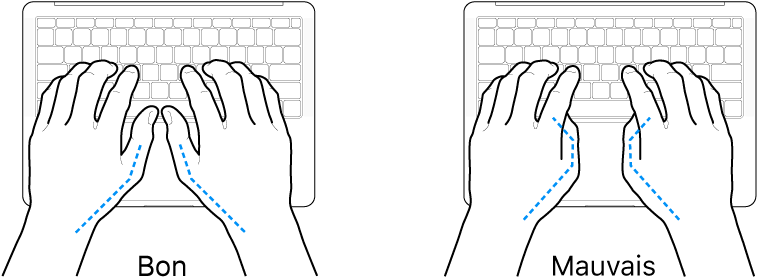 Mains placées sur un clavier, montrant la bonne et la mauvaise position des pouces.