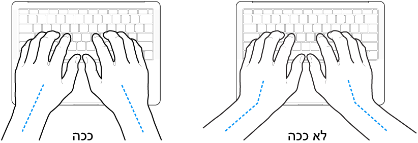ידיים מעל מקלדת, להדגמת מנח נכון ומנח שגוי של כף היד ושורש כף היד.