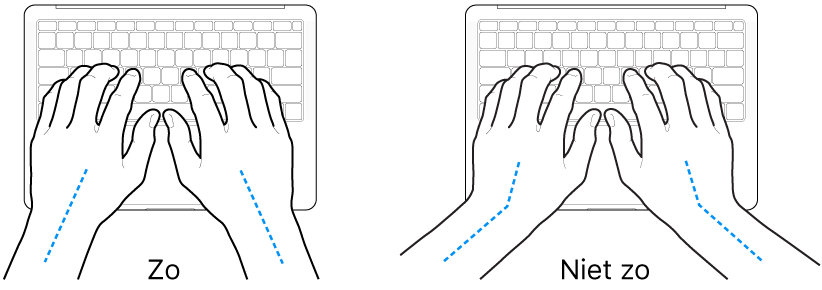Handen boven een toetsenbord, waarbij de goede en verkeerde stand van de handen en polsen wordt aangegeven.