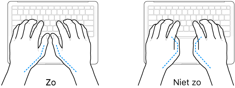 Handen boven een toetsenbord, waarbij de goede en verkeerde stand van de duimen wordt aangegeven.
