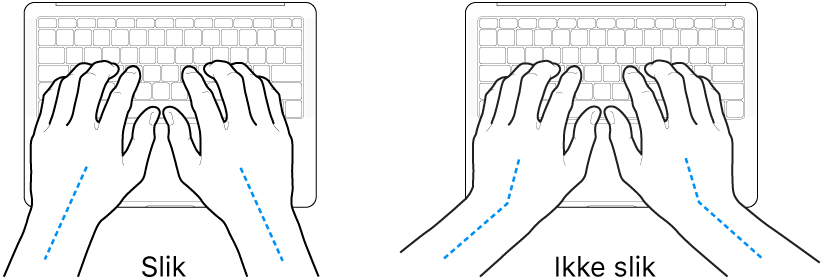 Hender plassert over et tastatur som viser riktig og feil stilling for håndledd og hender.