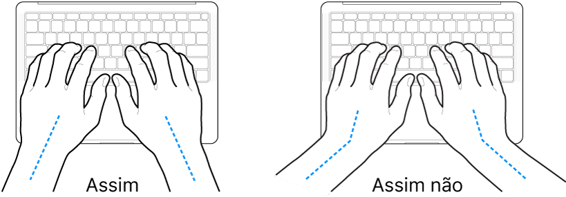 As mãos posicionadas sobre um teclado a mostrar alinhamentos corretos e incorretos das mãos e dos pulsos.