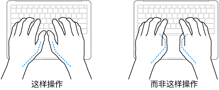 手掌放在键盘上方，显示拇指的正确放置和错误放置。
