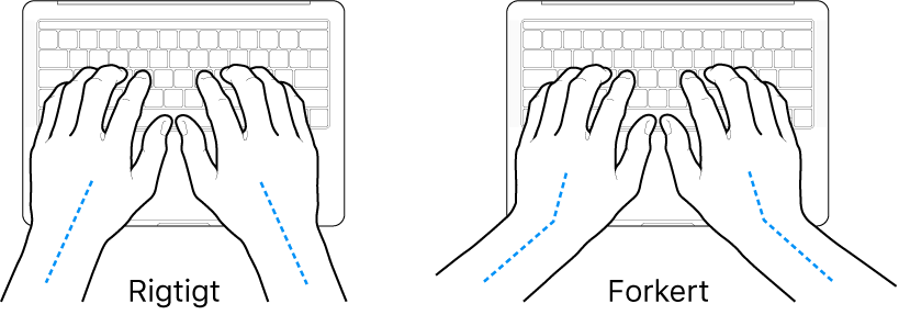 Hænder anbragt over et tastatur med rigtig og forkert position af håndled og hånd.