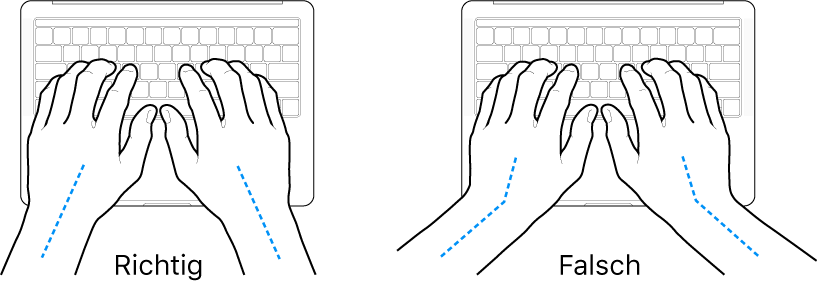 Tastatur und Hände in richtiger und falscher Haltung von Handgelenk und Händen
