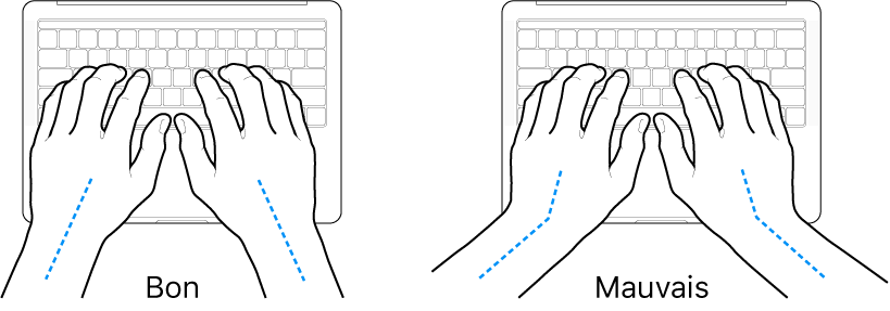 Mains placées sur un clavier, montrant le bon et le mauvais alignement des poignets et des mains.