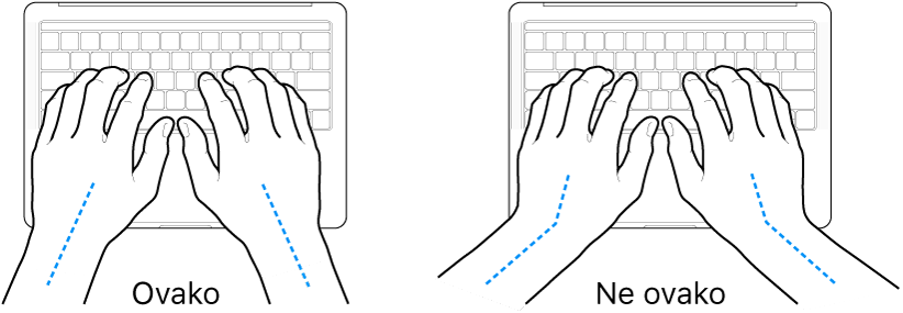 Ruke položene na tipkovnicu s prikazom pravilnog i nepravilnog položaja zapešća i ruku.