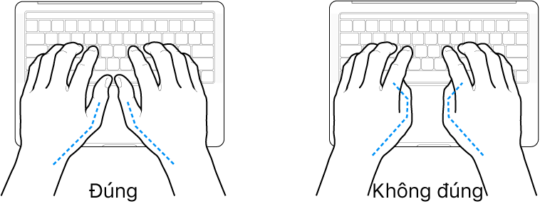 Các bàn tay đặt phía trên bàn phím, minh họa cách đặt ngón cái đúng và sai.
