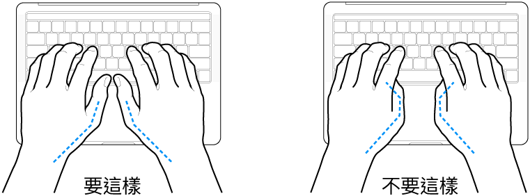 雙手置於鍵盤上，分別顯示正確與不正確的大腿姿勢。