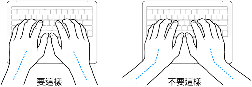 雙手置於鍵盤上，分別顯示正確與不正確的手肘與雙手對稱擺放位置。