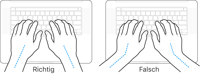 Tastatur und Hände in richtiger und falscher Haltung von Handgelenk und Händen