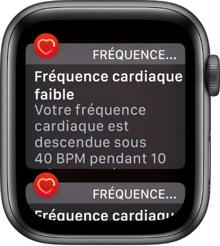 Un écran d’alerte de rythme cardiaque indiquant qu’un rythme cardiaque faible a été détecté.