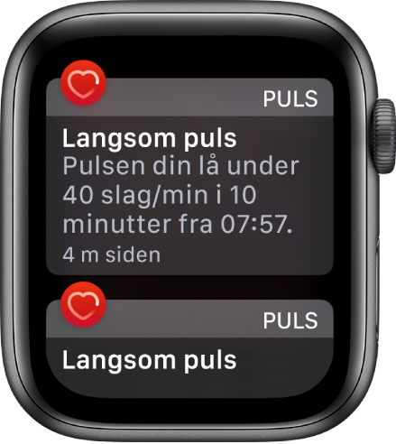 En pulsvarsel-skjerm som viser at langsom puls er registrert.