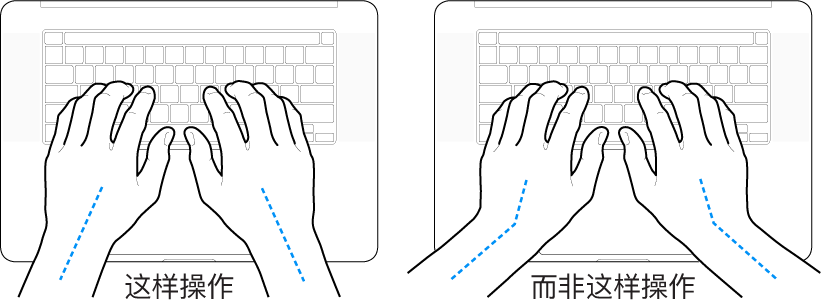 手掌放在键盘上方，显示手腕和手掌的正确对齐位置和错误对齐位置。
