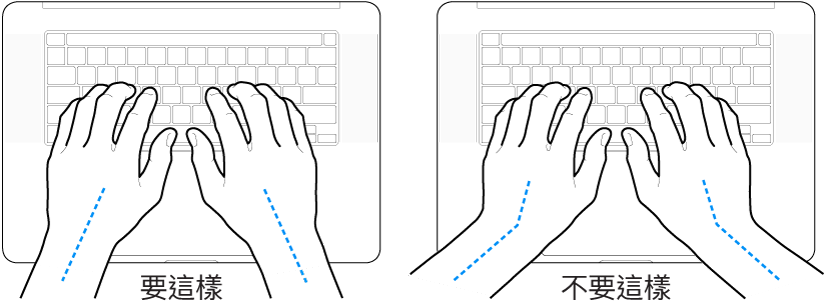 雙手置於鍵盤上，分別顯示正確與不正確的手肘與雙手對稱擺放位置。