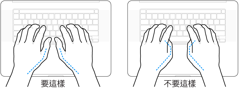 雙手置於鍵盤上，分別顯示正確與不正確的大腿姿勢。
