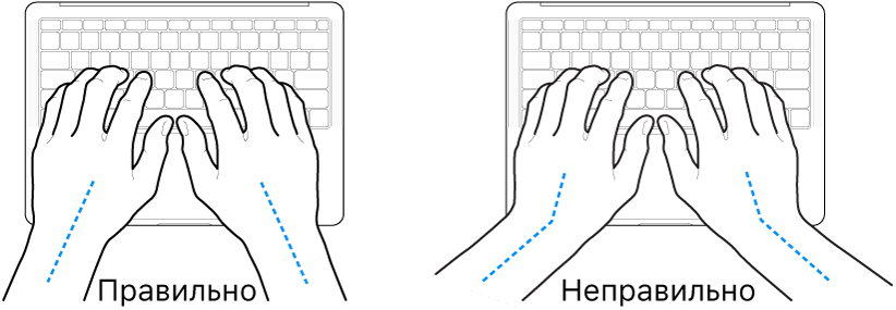Руки розташовано над клавіатурою й показано правильне та неправильне положення кистей і рук.