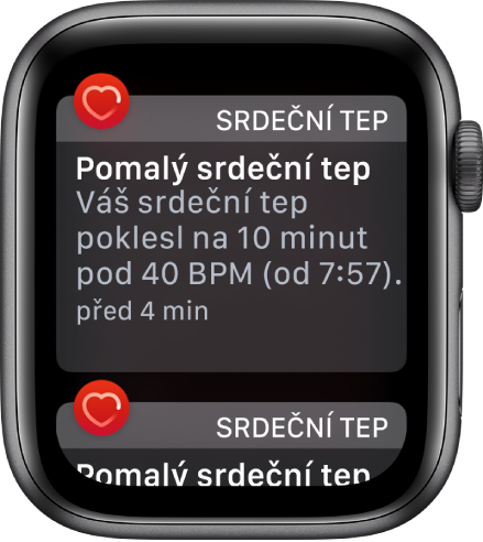 Obrazovka Upozornění na srdeční tep oznamující, že byla zaznamenána nízká srdeční frekvence.