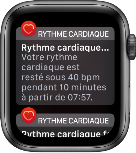 L’écran Alerte de Rythme cardiaque qui indique la détection d’un rythme cardiaque faible.